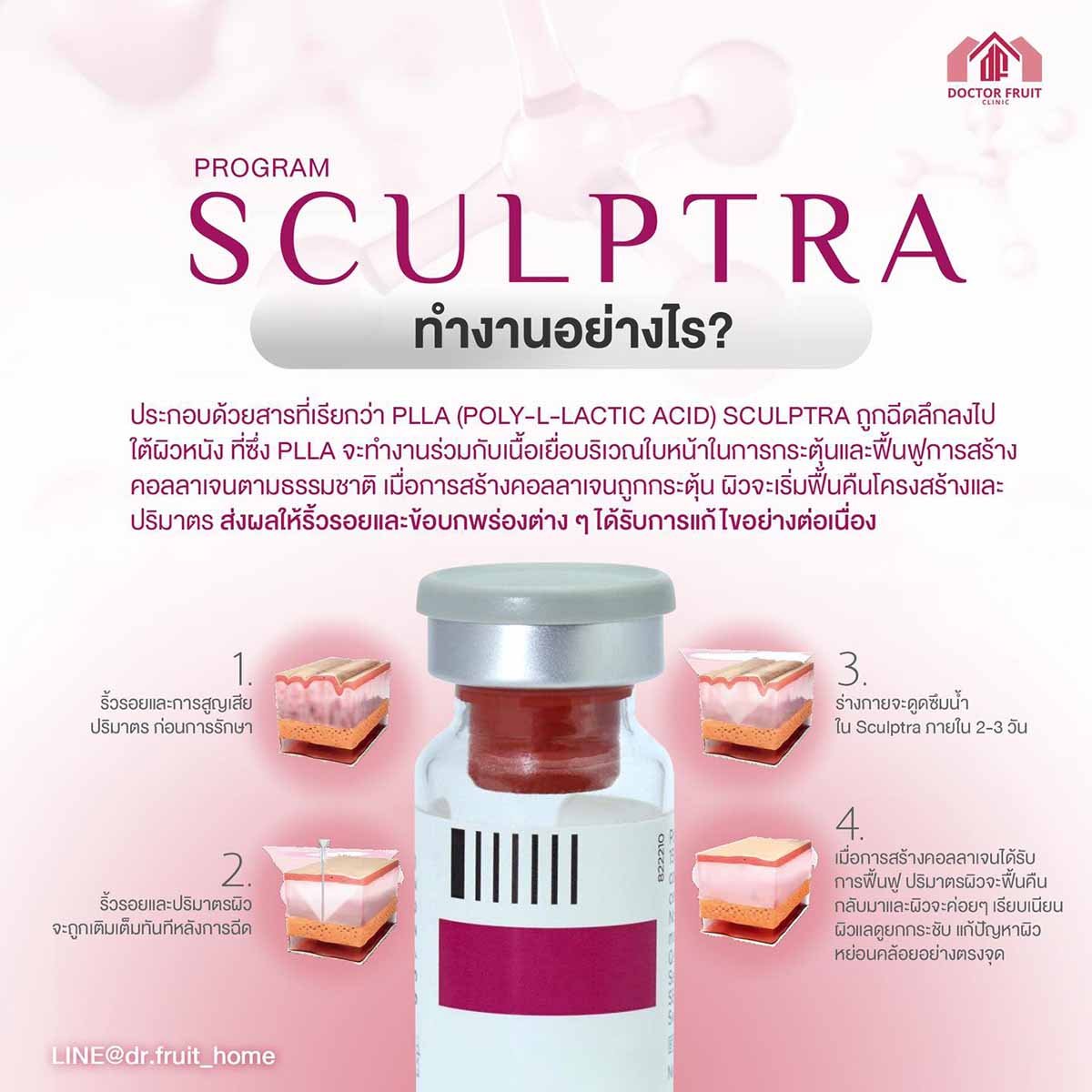 โปรแกรม SCULPTRA