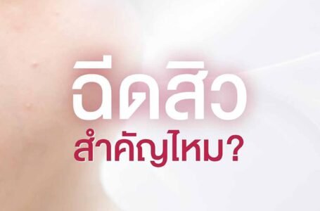 ฉีดสิว สำคัญไหม? ข้อดีของการฉีดสิว รักษาสิว