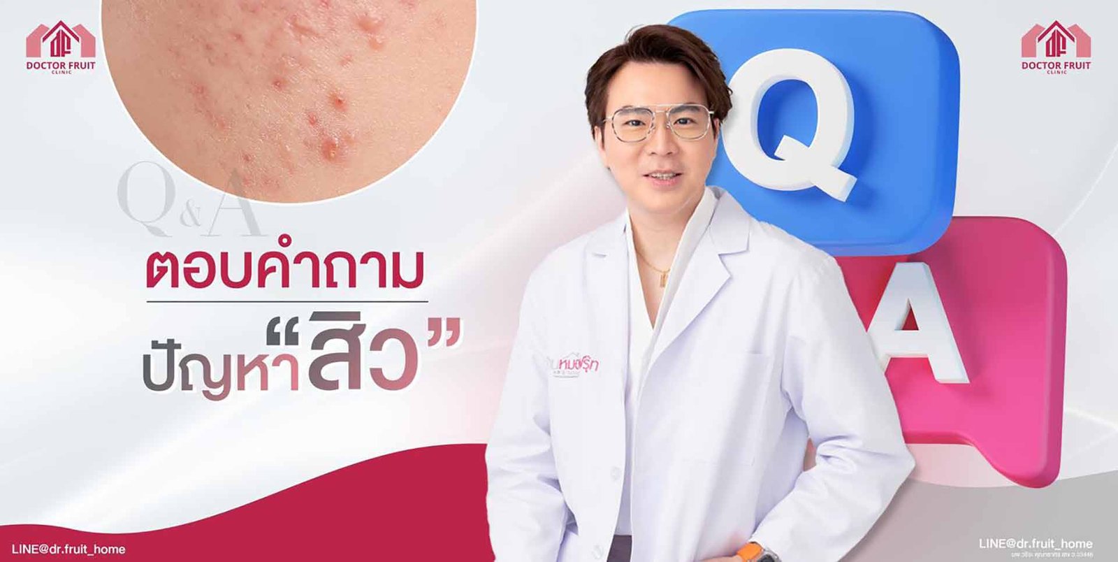 ปัญหาสิว