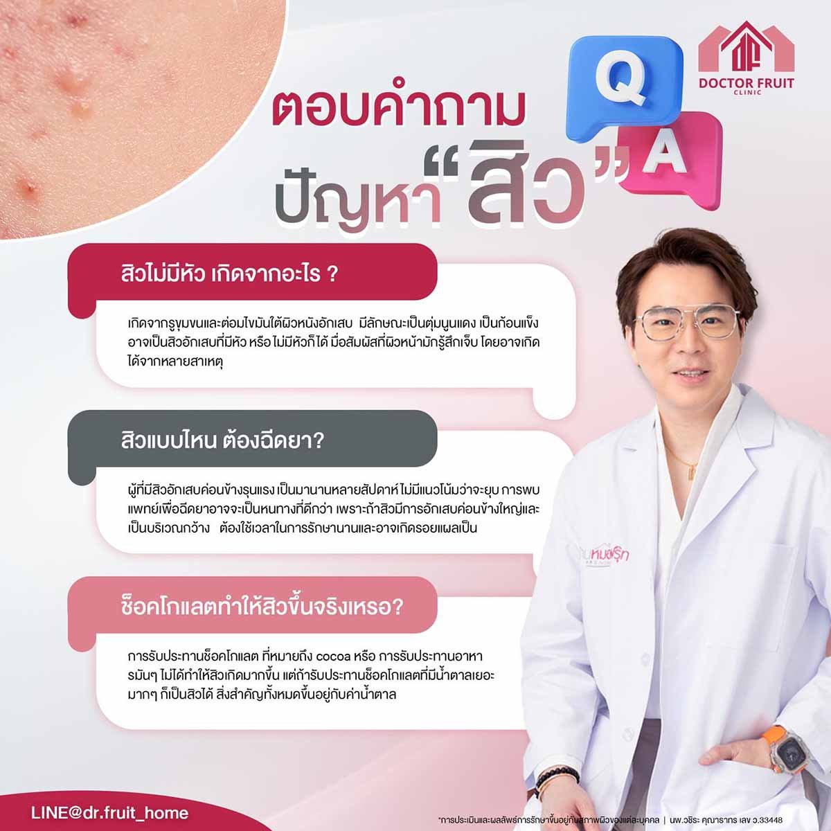 ปัญหาสิว